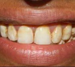 FB_IMG_1508583983081 - Copy