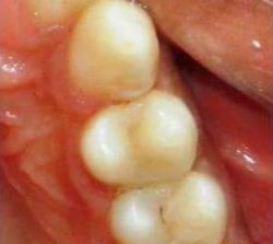 FB_IMG_1508583994210