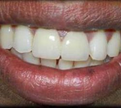 FB_IMG_1508584005192