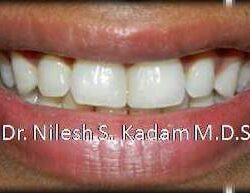 FB_IMG_1508584022171