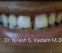 FB_IMG_1508584022171 - Copy